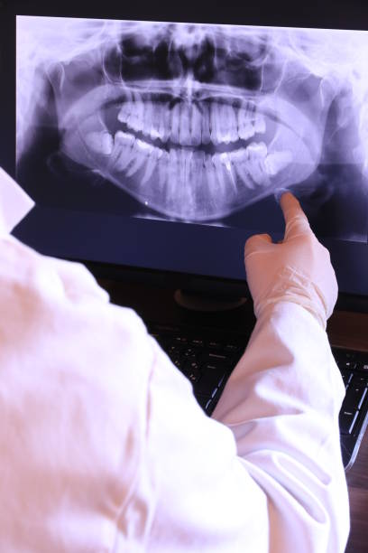 Best Emergency Denture Repair in Selinsgrove, PA