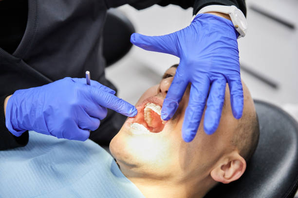 Best Emergency Treatment for Oral Infections in Selinsgrove, PA